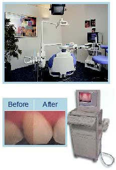 Exam whitening
