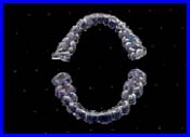 Stents Stents